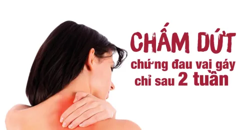 CHẤM DỨT CHỨNG ĐAU VAI GÁY CHỈ SAU 2 TUẦN